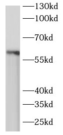 ARIH2 antibody|ARIH2抗体