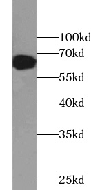 ZNF326 antibody|ZNF326抗体
