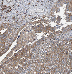 CD59 antibody|CD59抗体