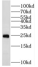RAB2A antibody|RAB2A抗体