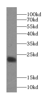 SSR2 antibody|SSR2抗体