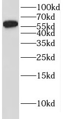 IRF6 antibody|IRF6抗体