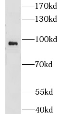 CNKSR1 antibody|CNKSR1抗体