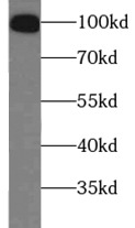 TRPV1 antibody|TRPV1抗体 FNab098