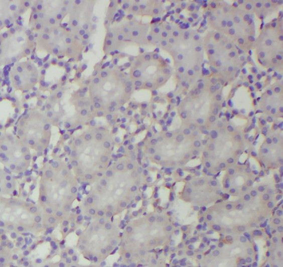 RNF181 antibody|RNF181抗体