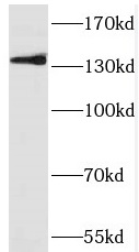 PRDM10 antibody|PRDM10抗体
