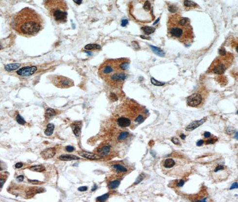 ERK1/2 antibody|ERK1/2抗体 FNab0