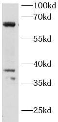 IRAK3 antibody|IRAK3抗体 FNab101