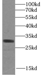 SULT1A4 antibody|SULT1A4抗体