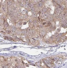 TMF1-Specific antibody|TMF1抗体