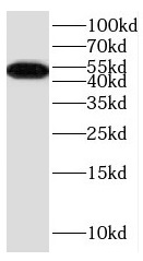DRD5 antibody|DRD5抗体