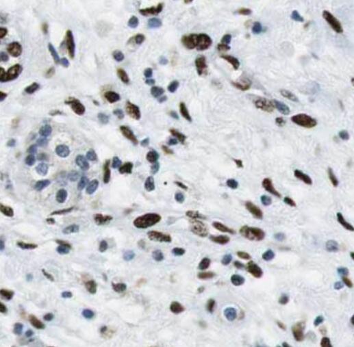 SGK2 antibody|SGK2抗体