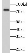 SYK antibody|SYK抗体 FNab08414