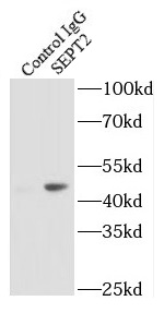 RPAP1 antibody|RPAP1抗体 FNab073