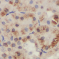 RPS6KB2 antibody|RPS6KB2抗体 FNa