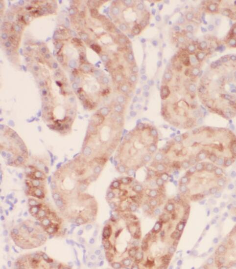 PEX11G antibody|PEX11G抗体