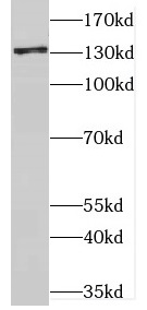 CNTN1 antibody|CNTN1抗体