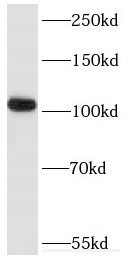 RAPGEF4 antibody|RAPGEF4抗体 FNa