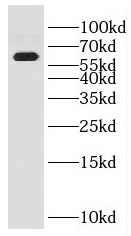 ENPP4 antibody|ENPP4抗体