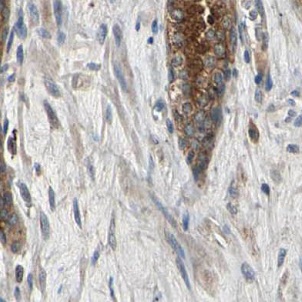 GALNT4 antibody|GALNT4抗体