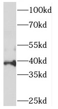 PIGA antibody|PIGA抗体