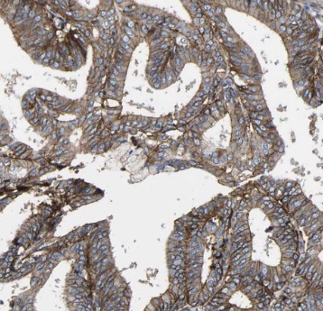 TSP50 antibody|TSP50抗体