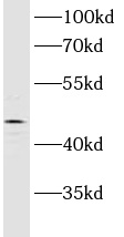 ASCC1 antibody|ASCC1抗体