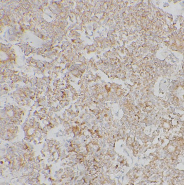 TSPAN12 antibody|TSPAN12抗体 FNa