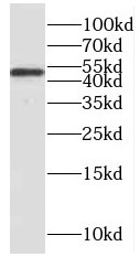 PPP2R2C antibody|PPP2R2C抗体