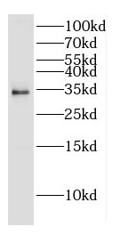 CNOT7 antibody|CNOT7抗体