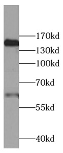 CFH antibody|CFH抗体
