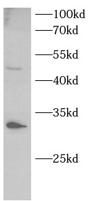 UCP2 antibody|UCP2抗体 FNab10373