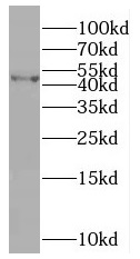SLFNL1 antibody|SLFNL1抗体