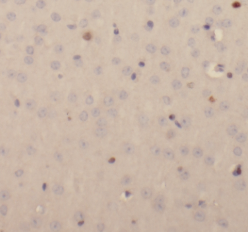 EPB41L3 antibody|EPB41L3抗体