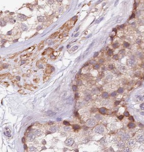 UBE2DNL antibody|UBE2DNL抗体