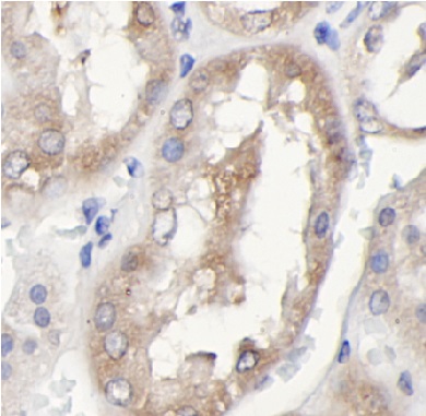SUPT6H antibody|SUPT6H抗体 FNab1