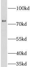 MX1 antibody|MX1抗体 FNab09996