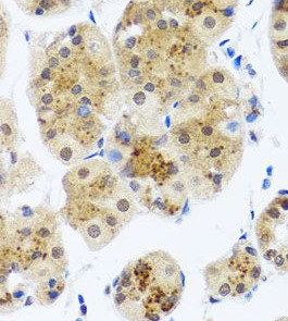 RAD23B antibody|RAD23B抗体