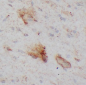 MED4 antibody|MED4抗体 FNab10105