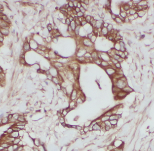 ATP6V1B2 antibody|ATP6V1B2抗体