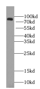 ZNF600-Specific antibody|ZNF60