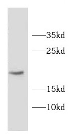 CD59 antibody|CD59抗体