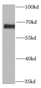 PRODH antibody|PRODH抗体