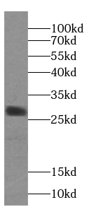 CAPNS2 antibody|CAPNS2抗体