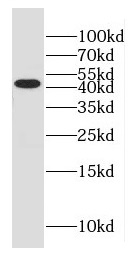 GLUL antibody|GLUL抗体