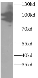 PIK3R2 antibody|PIK3R2抗体