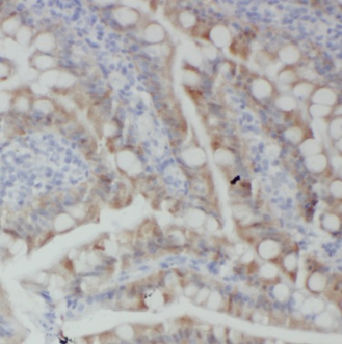 BTG2 antibody|BTG2抗体