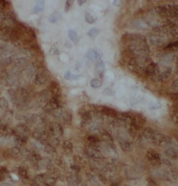 SOD1 antibody|SOD1抗体 FNab09989