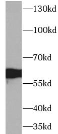 AHSG antibody|AHSG抗体 FNab03080