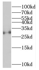 SYCP3 antibody|SYCP3抗体